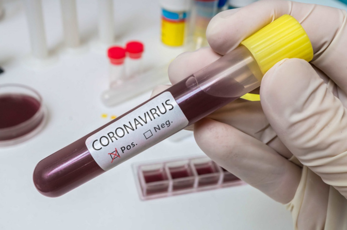 Coronavirus : encore 18 décès en 24 heures, mais hospitalisations en léger recul en Normandie 