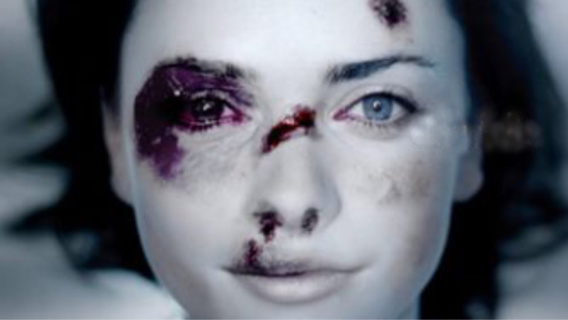 Photo d'illustration pour une campagne de sensibilisation aux violences faites aux femmes