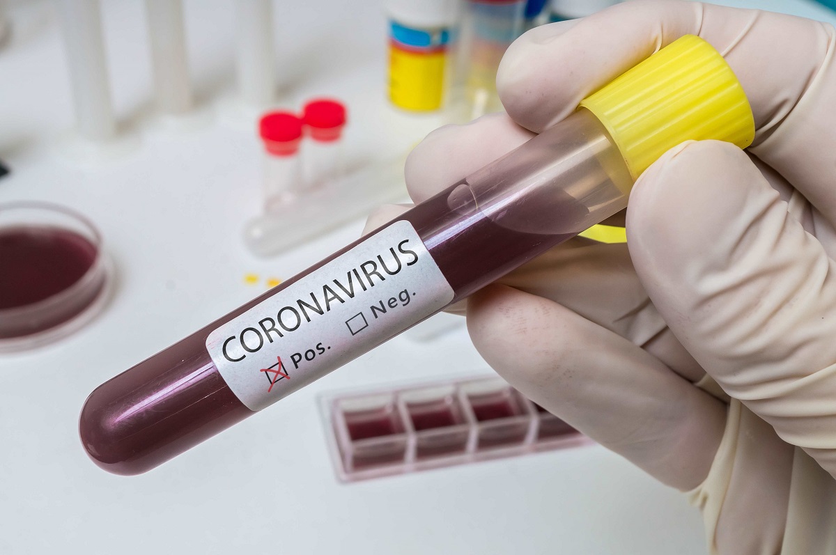 16% des 6 793 prélèvements effectués depuis le 24 février, se sont révélés positifs au coronavirus - Illustration © iStockphoto