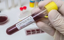 Coronavirus : encore des décès et de nouveaux cas en Normandie au cours de ces dernières 24 h 